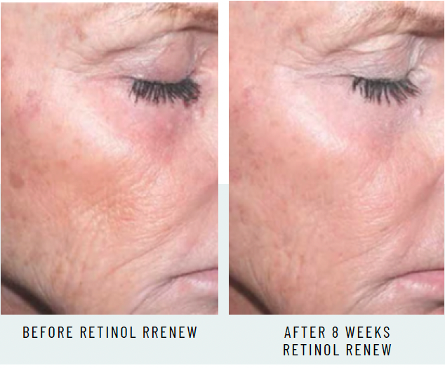 RETINOL RENEW